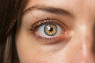 what-is-commonly-misdiagnosed-as-pink-eye