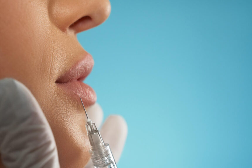 The New Era of Natural Lip Filler Trends in 2025